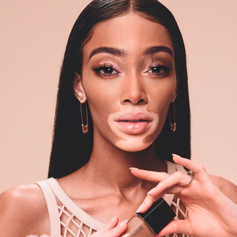 Chantelle Brown-Young / Winnie Harlow